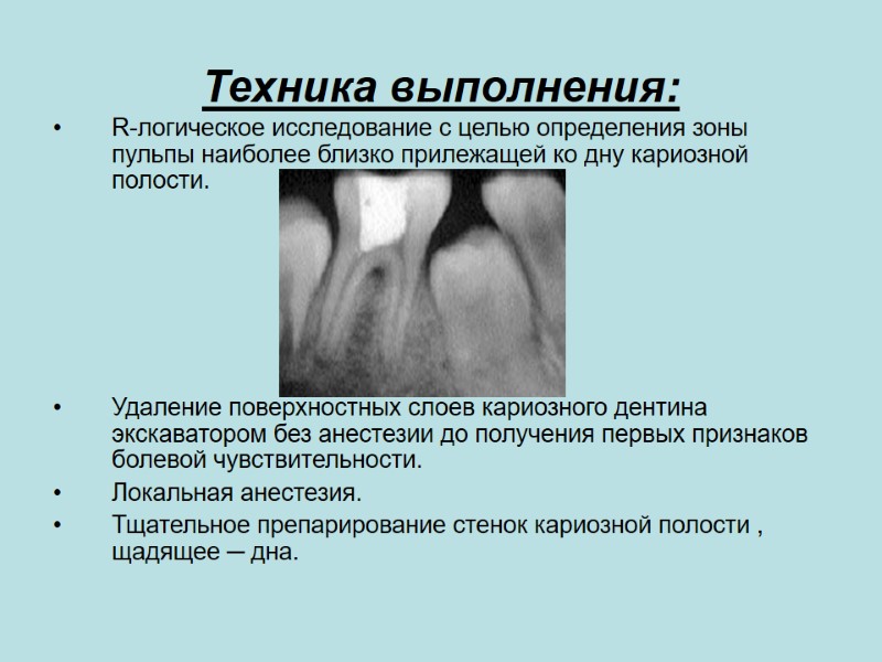 Техника выполнения:  R-логическое исследование с целью определения зоны пульпы наиболее близко прилежащей ко